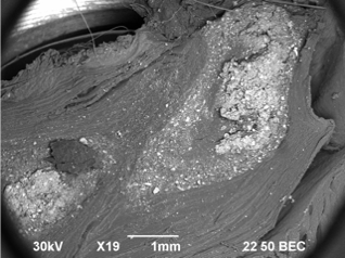 ДЕПО АЛЛОГЕННОГО ГАП В МЫШЕЧНОЙ ТКАНИ 